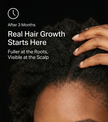 Morihair Biotin Gummies